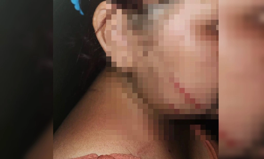 Grávida foi espancada