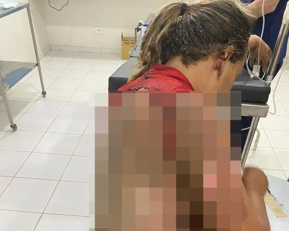 Homem é preso suspeito de atear fogo na companheira enquanto ela dormia no Piauí