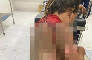 Homem é preso suspeito de atear fogo na companheira enquanto ela dormia no Piauí (Foto: Reprodução) Homem é preso suspeito de atear fogo na companheira enquanto ela dormia no Piauí (Foto: Reprodução)
