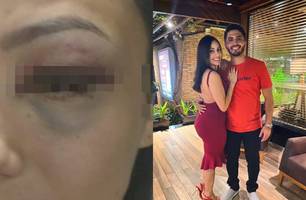 Mulher é espancada por namorado e pode perder o olho; agressor é servidor do TJ-PI (Foto: Reprodução) Mulher é espancada por namorado e pode perder o olho; agressor é servidor do TJ-PI (Foto: Reprodução)