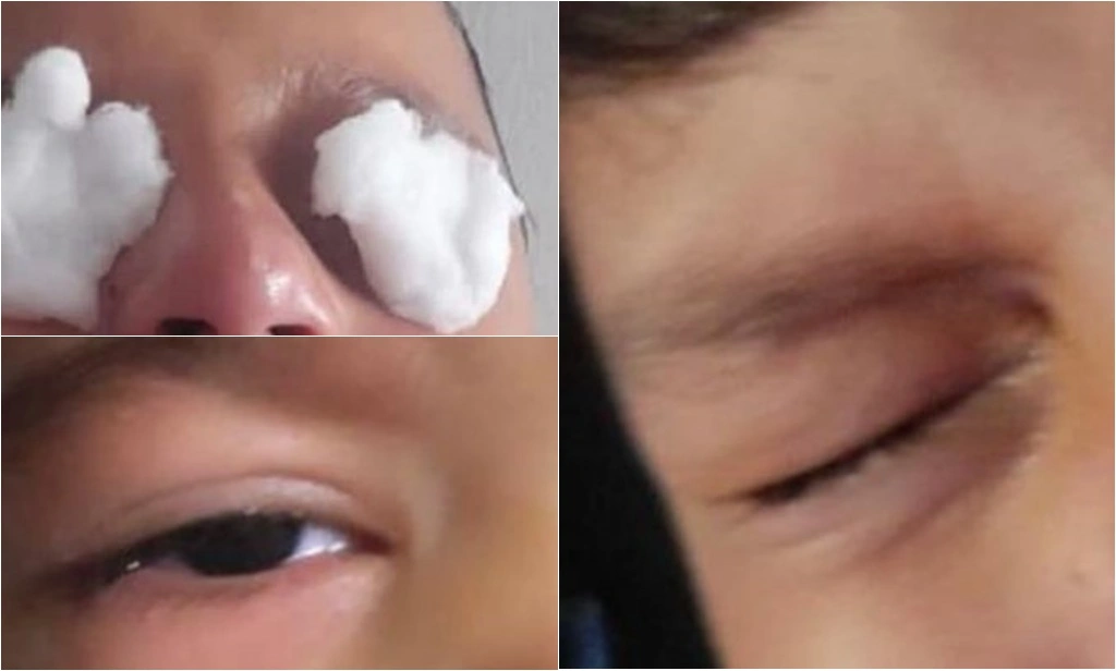 Reação sofrida pelas crianças