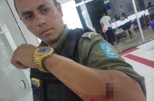 Policial militar é baleado por criminoso durante abordagem em Teresina (Foto: Reprodução) Policial militar é baleado por criminoso durante abordagem em Teresina (Foto: Reprodução)
