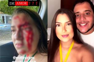 Jovem foi agredida pelo namorado em Teresina (Foto: Reprodução/ Instagram) Jovem foi agredida pelo namorado em Teresina (Foto: Reprodução/ Instagram)