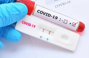 Teste de Covid-19 (Foto: Divulgação/ Procon/ MS) Teste de Covid-19 (Foto: Divulgação/ Procon/ MS)