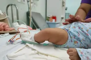 Sesapi vai abrir leitos pediátricos para enfrentamento de síndromes respiratórias (Foto: Divulgação/Ascom) Sesapi vai abrir leitos pediátricos para enfrentamento de síndromes respiratórias (Foto: Divulgação/Ascom)