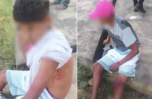 Jovens esfaqueiam menor por causa de vídeo íntimo (Foto: Divulgação/ PM-PI) Jovens esfaqueiam menor por causa de vídeo íntimo (Foto: Divulgação/ PM-PI)