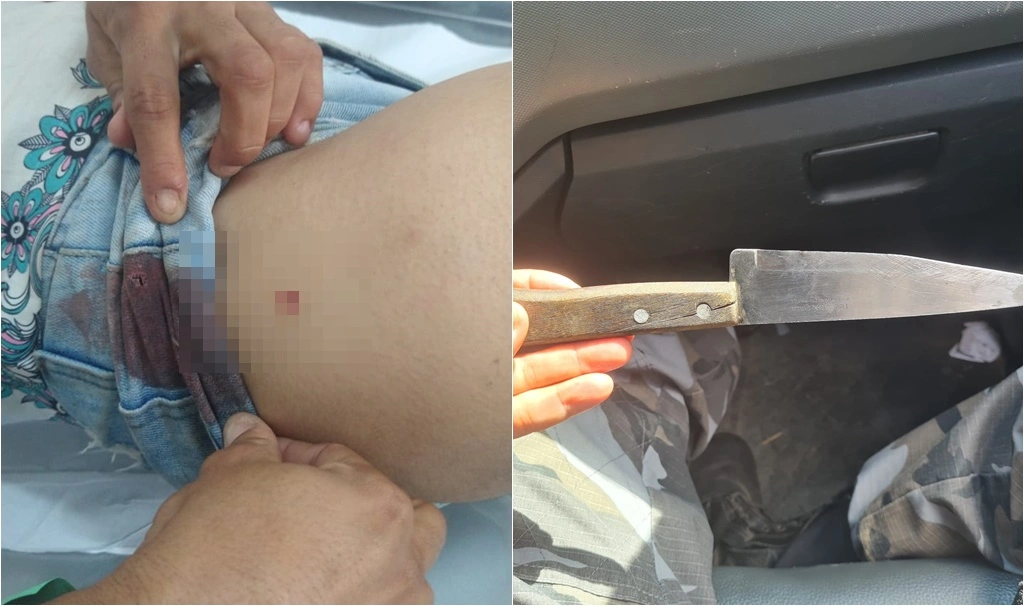 Mulher foi esfaqueada pelo marido
