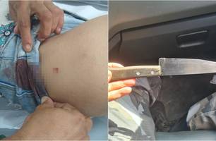 Mulher foi esfaqueada pelo marido (Foto: Reprodução)