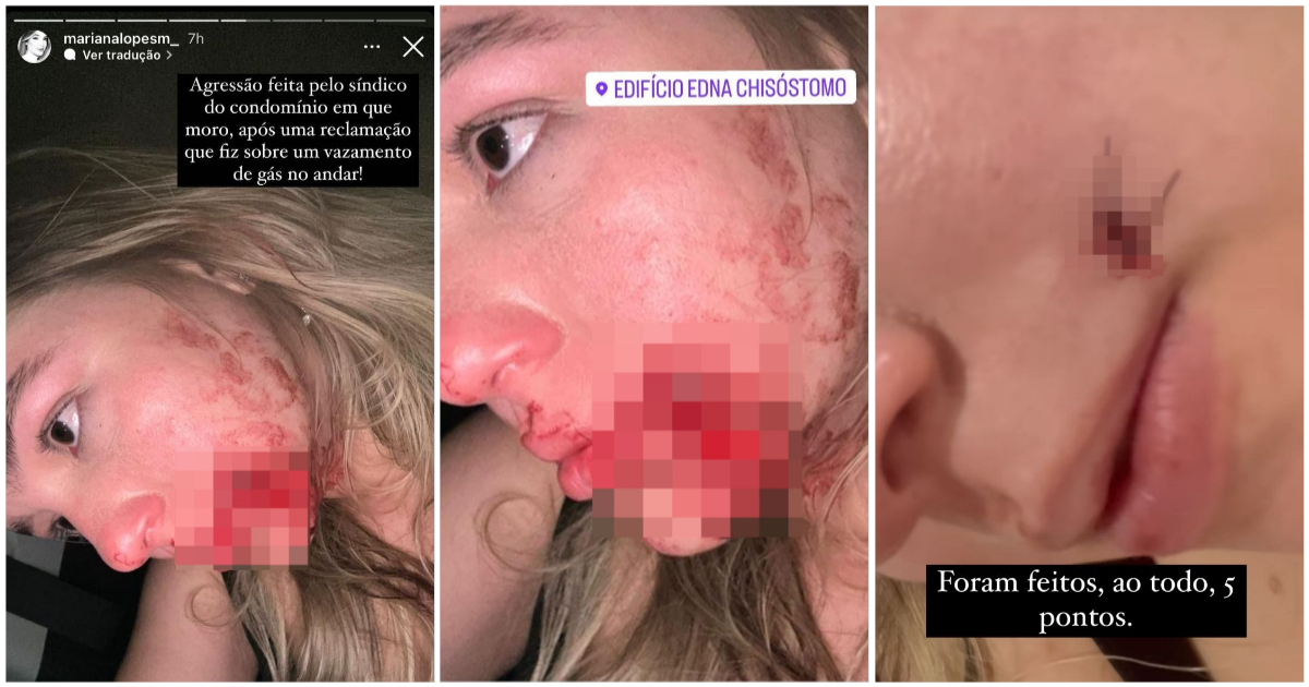 Modelo acusa síndico de agressão em condomínio na zona Leste de Teresina