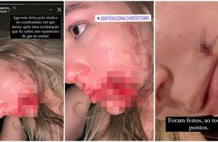 Modelo acusa síndico de agressão em condomínio na zona Leste de Teresina (Foto: Reprodução) Modelo acusa síndico de agressão em condomínio na zona Leste de Teresina (Foto: Reprodução)