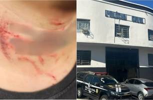 Homem é estuprado e agredido por namorado de amiga (Foto: Reprodução) Homem é estuprado e agredido por namorado de amiga (Foto: Reprodução)
