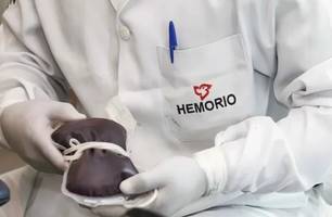 O caso também está sendo investigado pelo Ministério da Saúde (Foto: Divulgação)