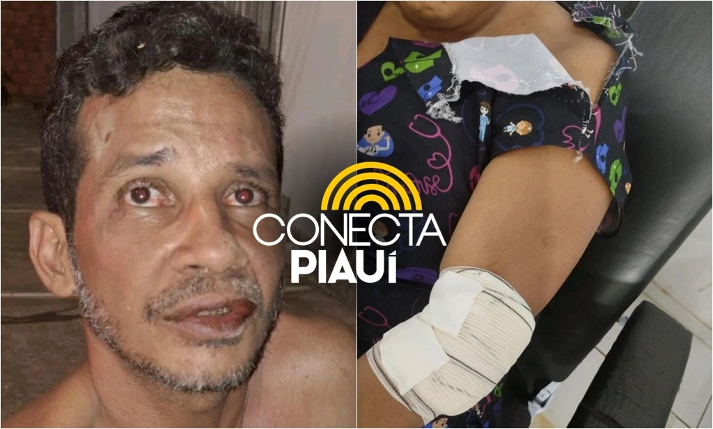 Mulher é esfaqueada pelo próprio companheiro em Demerval Lobão