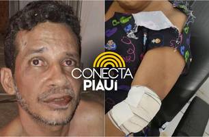 Mulher é esfaqueada pelo próprio companheiro em Demerval Lobão (Foto: Reprodução) Mulher é esfaqueada pelo próprio companheiro em Demerval Lobão (Foto: Reprodução)