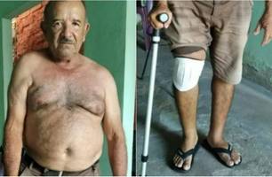 "Zezim" Messias foi assaltado e espancando dentro de casa em Barras (Foto: Reprodução) "Zezim" Messias foi assaltado e espancando dentro de casa em Barras (Foto: Reprodução)