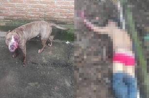 Bandido fica gravemente ferido após ser atacado por pitbull durante assalto (Foto: Reprodução) Bandido fica gravemente ferido após ser atacado por pitbull durante assalto (Foto: Reprodução)
