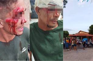 Homem denuncia que foi agredido por comandante da Polícia Militar em bar no Piauí (Foto: Reprodução) Homem denuncia que foi agredido por comandante da Polícia Militar em bar no Piauí (Foto: Reprodução)