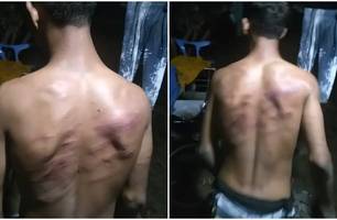 Mãe denuncia agressão sofrida pelo filho (Foto: Reprodução) Mãe denuncia agressão sofrida pelo filho (Foto: Reprodução)
