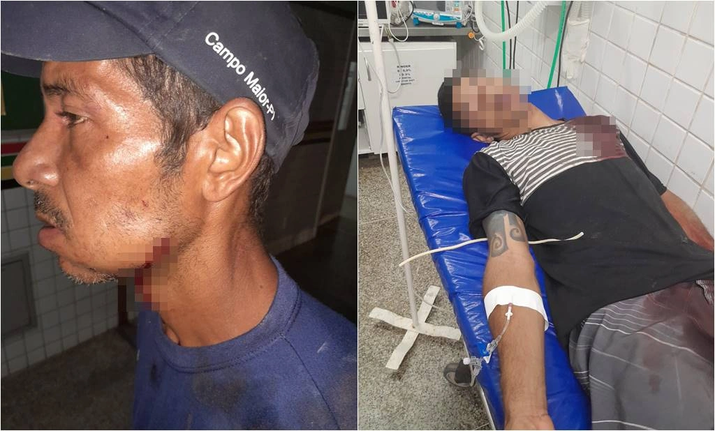 Dois homens baleados em Teresina