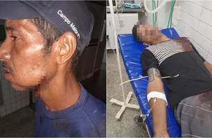 Dois homens baleados em Teresina (Foto: Conecta Piauí)