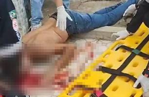 Homem fica gravemente ferido após sofrer acidente de moto em Luzilândia (Foto: Reprodução) Homem fica gravemente ferido após sofrer acidente de moto em Luzilândia (Foto: Reprodução)