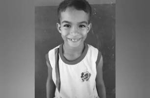 Criança morre devido as queimaduras (Foto: Reprodução) Criança morre devido as queimaduras (Foto: Reprodução)