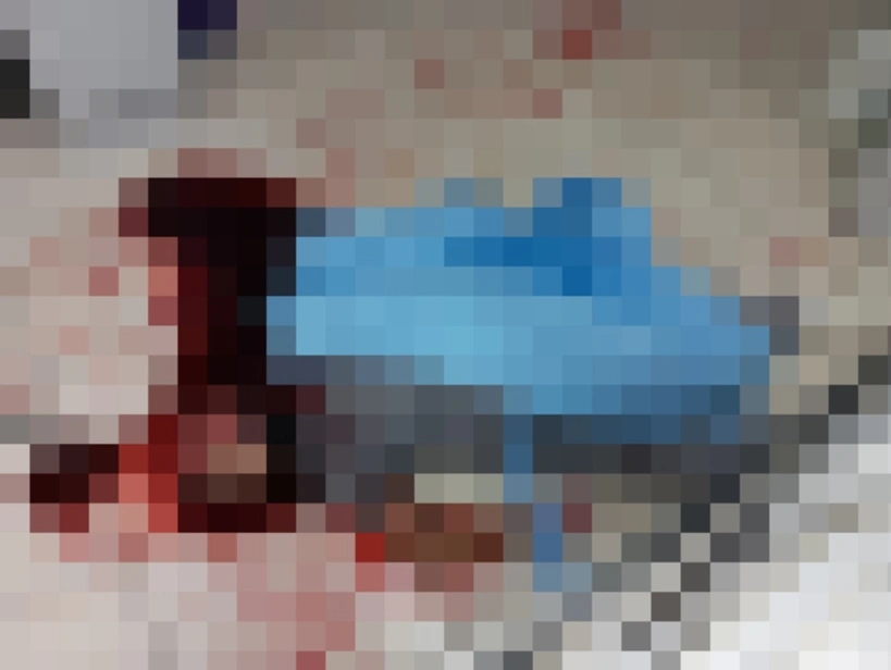 Homem é morto e decapitado em hospital