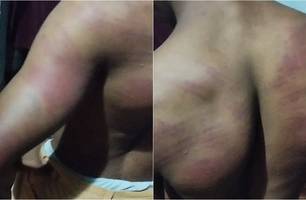 Jovem quilombola é espancado por policiais militares (Foto: Reprodução) Jovem quilombola é espancado por policiais militares (Foto: Reprodução)