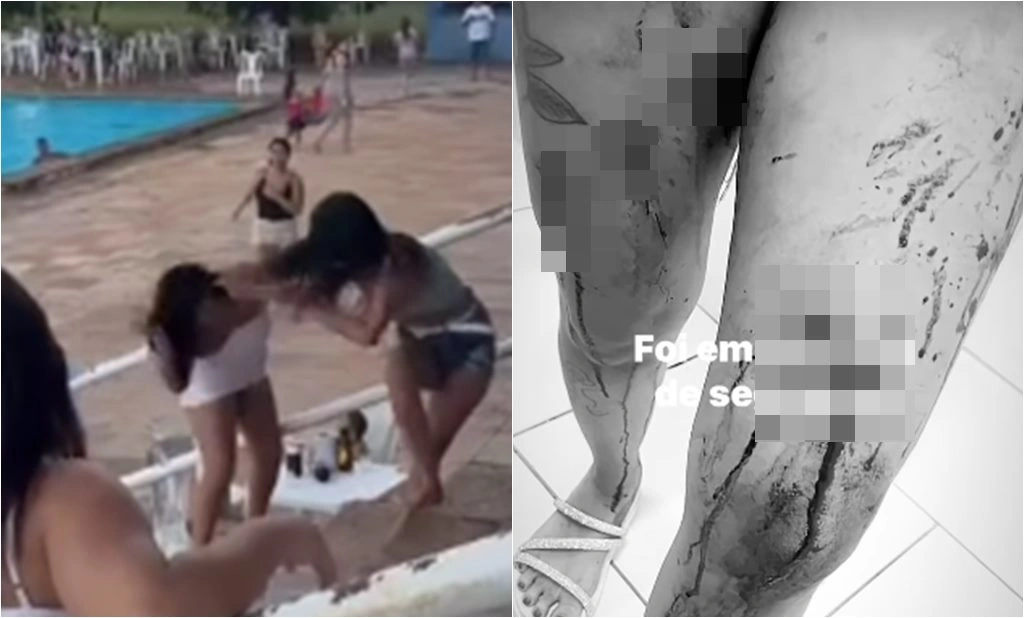 Blogueira é atingida com caco de vidro