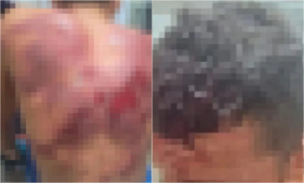 Homem é espancado em Pedro II