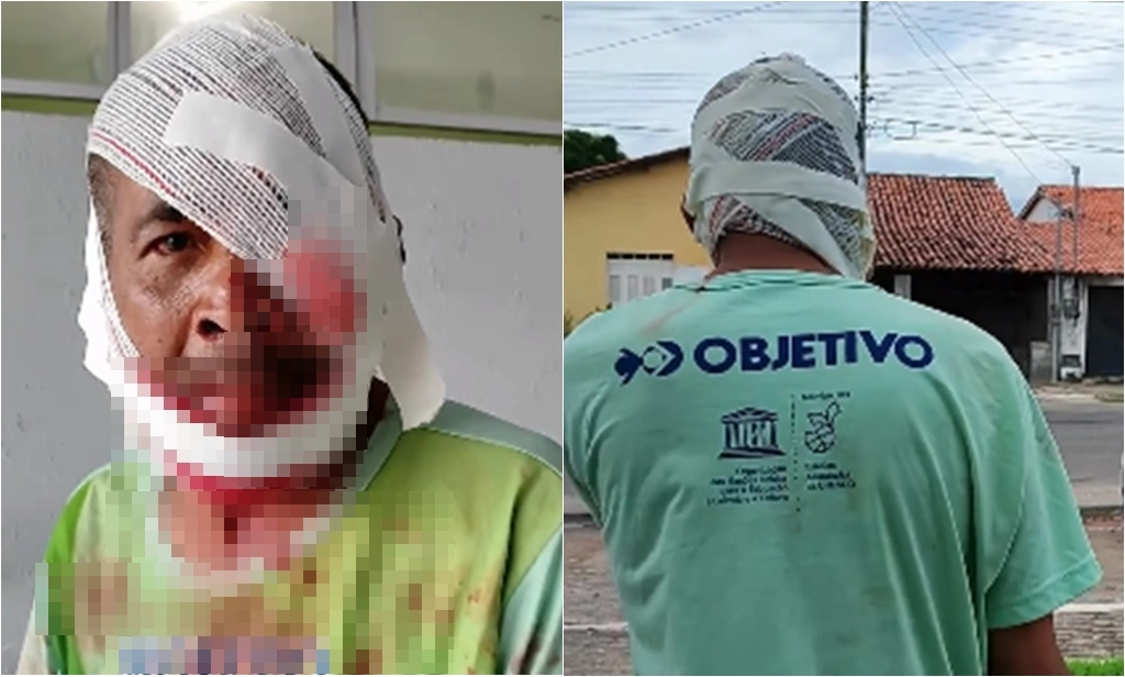 Homem traído é agredido após flagrar esposa com amante em Parnaíba