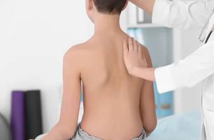 Dia de Conscientização da Escoliose: doença afeta entre 2% 4% da população entre 0 e 18 anos (Foto: Reprodução)