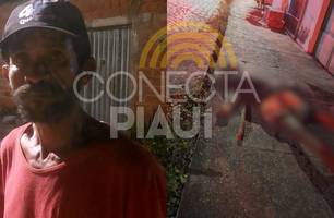 Homem conhecido como 'Olho do Gato' é assassinado na zona Sul de Teresina (Foto: Repórter 12/Conecta Piauí) Homem conhecido como 'Olho do Gato' é assassinado na zona Sul de Teresina (Foto: Repórter 12/Conecta Piauí)