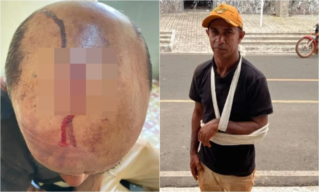 Homem é baleado e atingido por pedrada no Piauí