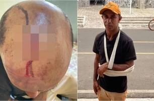 Homem é baleado e atingido por pedrada no Piauí (Foto: Portal Longah) Homem é baleado e atingido por pedrada no Piauí (Foto: Portal Longah)