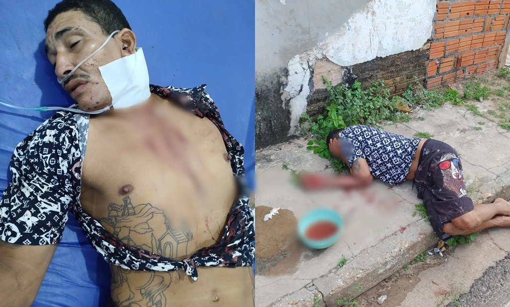 Homem foi atingido com tesoura no pescoço