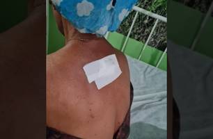 Mãe foi esfaqueada pelo filho (Foto: Reprodução) Mãe foi esfaqueada pelo filho (Foto: Reprodução)