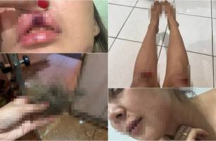 Mulher é brutalmente agredida pelo ex-namorado em via pública em Pedro II (Foto: Reprodução) Mulher é brutalmente agredida pelo ex-namorado em via pública em Pedro II (Foto: Reprodução)