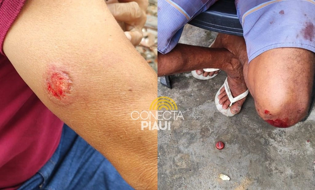 Homens são espancados na zona Sul de Teresina