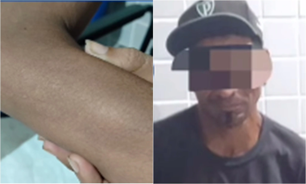 Mulher é agredida com cabo de enxada pelo próprio companheiro em Campo Maior