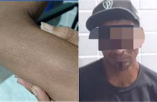 Mulher é agredida com cabo de enxada pelo próprio companheiro em Campo Maior (Foto: Reprodução/IG Notícias de Campo Maior) Mulher é agredida com cabo de enxada pelo próprio companheiro em Campo Maior (Foto: Reprodução/IG Notícias de Campo Maior)