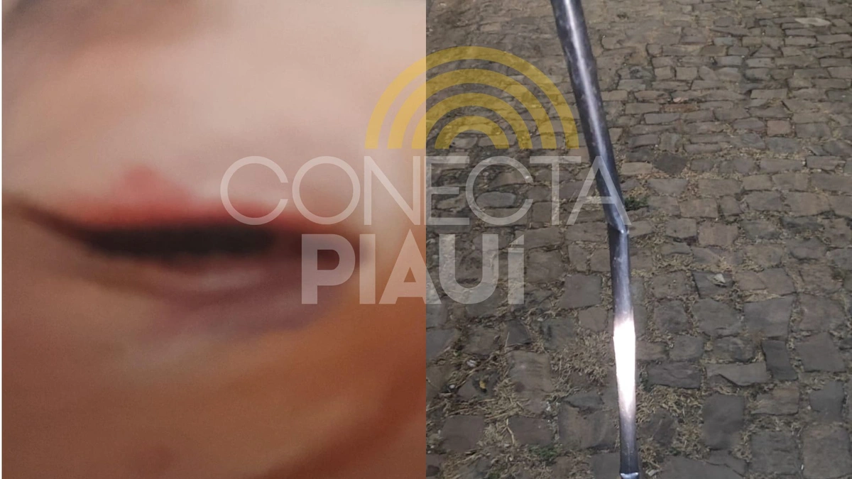 Mulher é espancada com cabo de vassoura pelo ex-namorado em Teresina