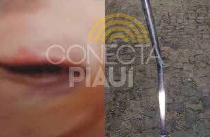 Mulher é espancada com cabo de vassoura pelo ex-namorado em Teresina (Foto: Repórter 12/Conecta Piauí) Mulher é espancada com cabo de vassoura pelo ex-namorado em Teresina (Foto: Repórter 12/Conecta Piauí)