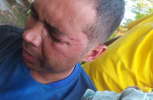 Professor é agredido por engenheiro em evento na zona rural de Demerval Lobão (Foto: Reprodução) Professor é agredido por engenheiro em evento na zona rural de Demerval Lobão (Foto: Reprodução)