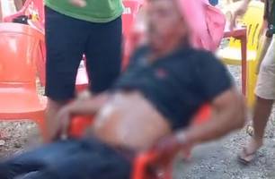 Segurança de festa é esfaqueado durante confusão em cidade do Piauí (Foto: Reprodução) Segurança de festa é esfaqueado durante confusão em cidade do Piauí (Foto: Reprodução)