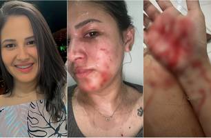 Blogueira é atacada com golpes de tesoura na frente de filha em município no Piauí (Foto: Reprodução) Blogueira é atacada com golpes de tesoura na frente de filha em município no Piauí (Foto: Reprodução)