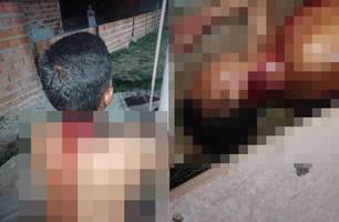 Irmão quase degola outro durante briga em município no Piauí (Foto: Reprodução) Irmão quase degola outro durante briga em município no Piauí (Foto: Reprodução)