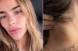 Modelo denuncia agressão pelo ex-namorado em Fortaleza (Foto: Reprodução)