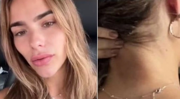 Modelo denuncia agressão pelo ex-namorado em Fortaleza