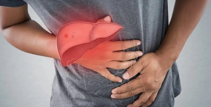 Saiba de uma vez por todas como acabar com a gordura no fígado